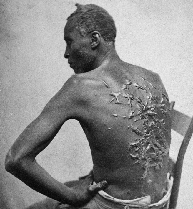 scourged_back_by_mcpherson_26_oliver2c_18632c_retouched
